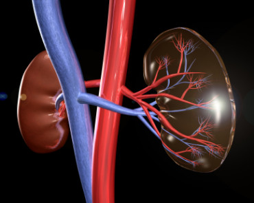 kidney transplant in india