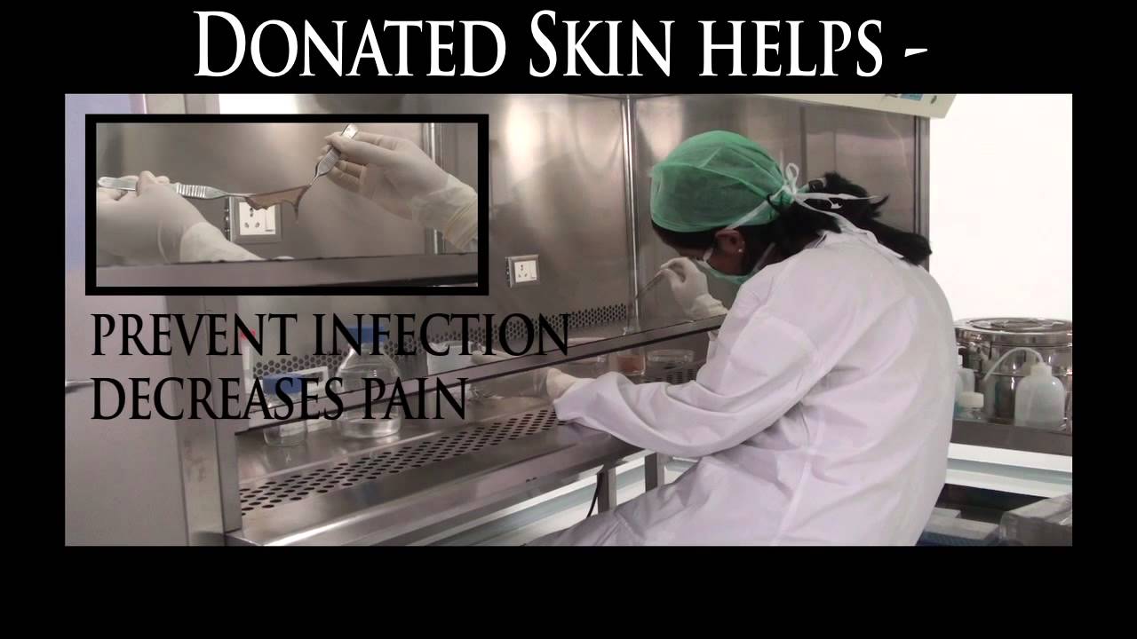 Skin Donation Awareness